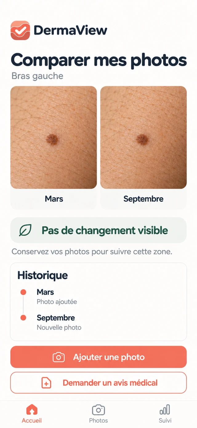 Aperçu illustratif : Historique & comparaison